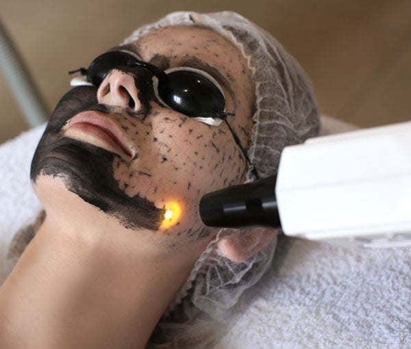Carbon Facial: What it is, Benefits, and Why You Should Book One Right Now